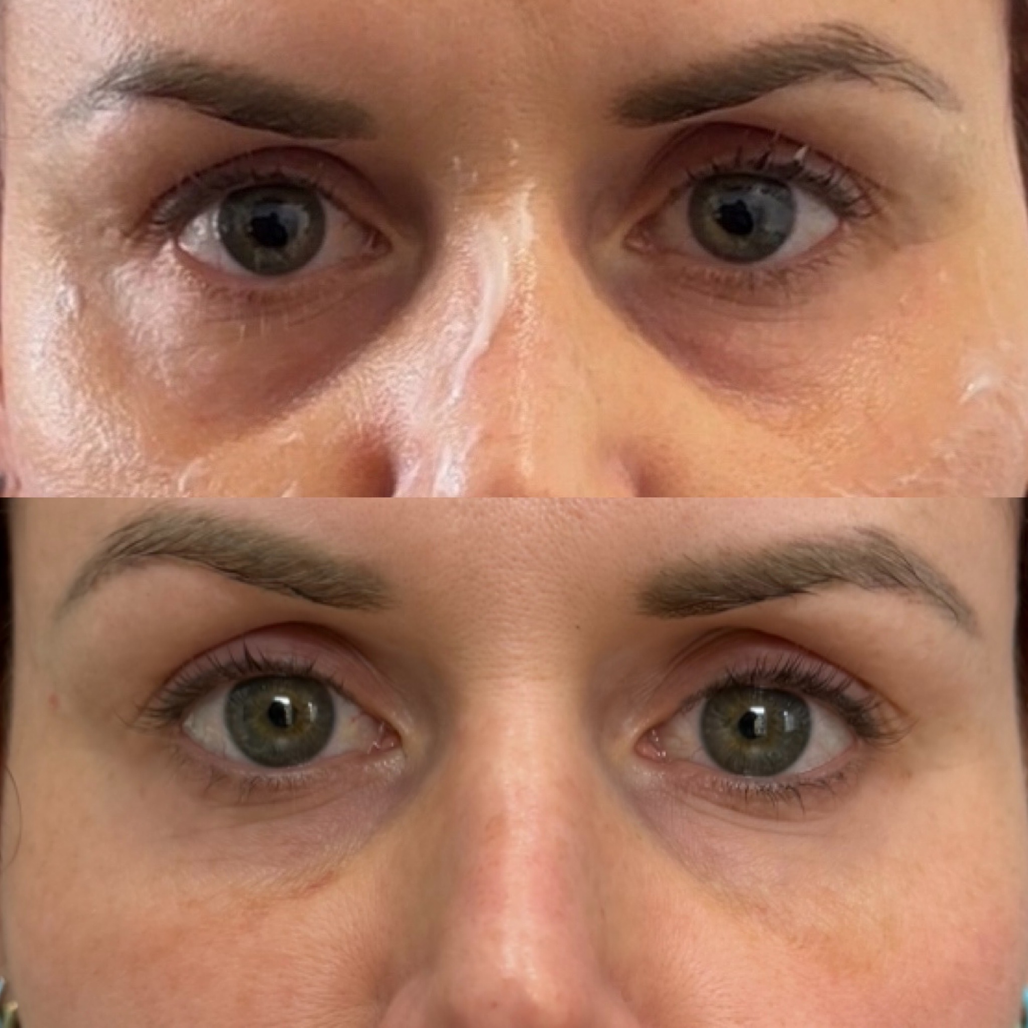 treatments inner thumb1